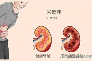 多特vs斯图加特首发：穆科科、阿德耶米先发，罗伊斯替补